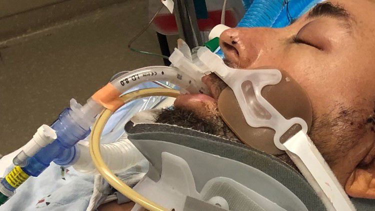 Man hanging Christmas lights falls from ladder, suffers traumatic injuries